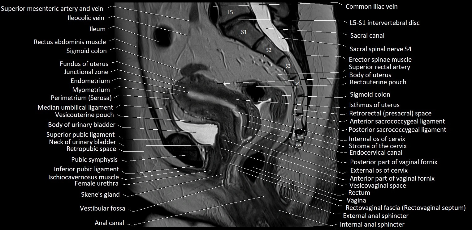 Sagittal cross sectional anatomy of female pelvis (MRI 3T) image 22.webp